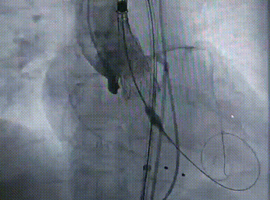 640_wx_fmt=gif&from=appmsg&tp=webp&wxfrom=10005&wx_lazy=1.gif