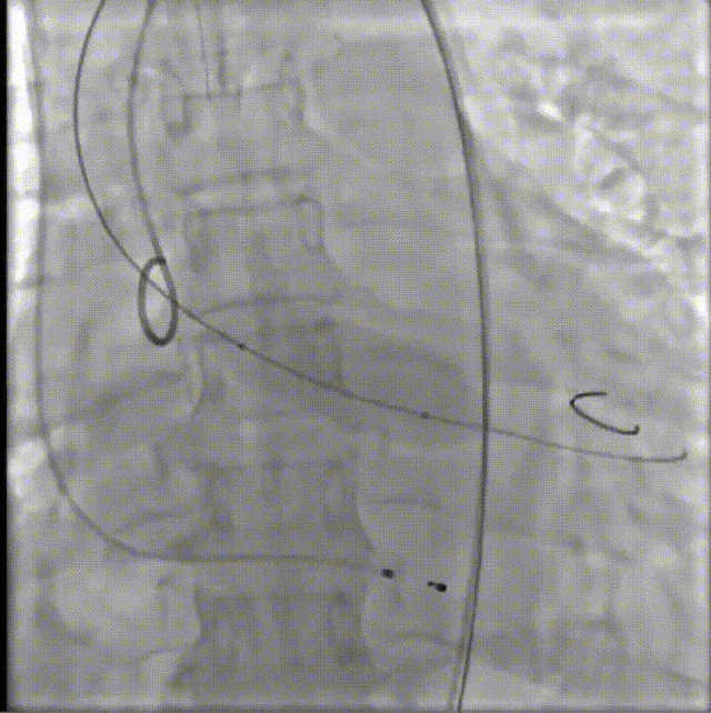 26.gif