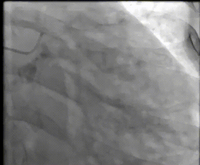 5.gif
