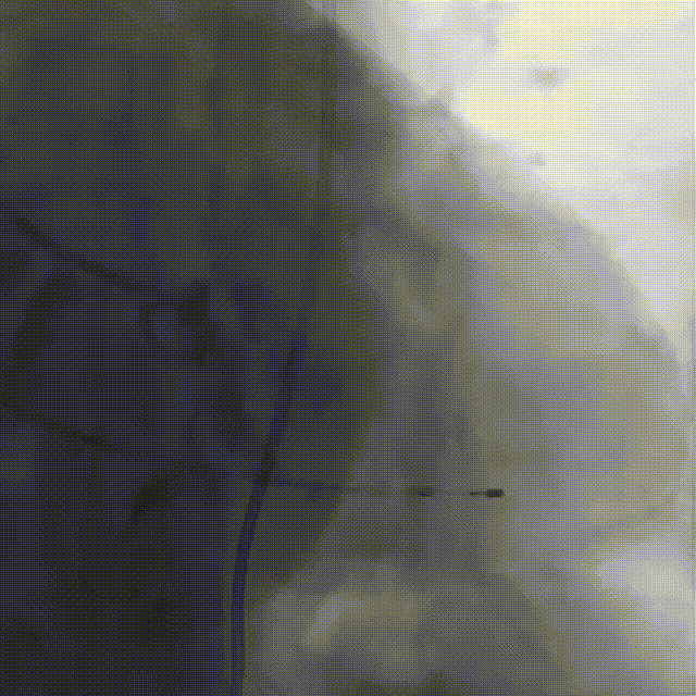 6.gif