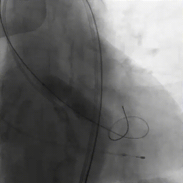 7.gif