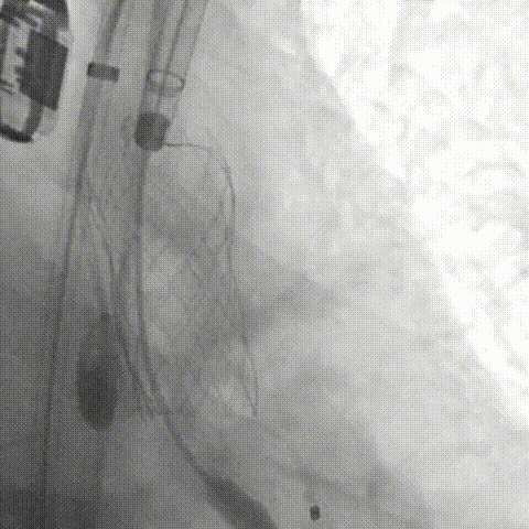 10.gif