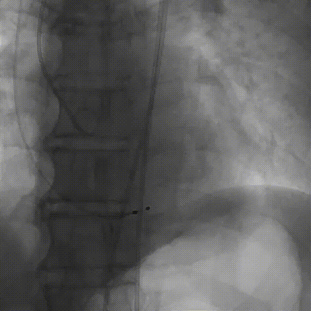 6.gif
