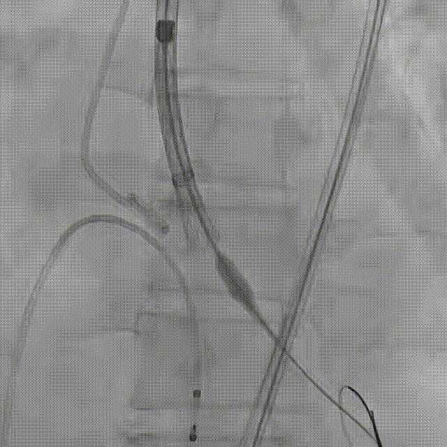 9.gif