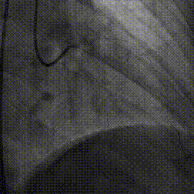 5.gif