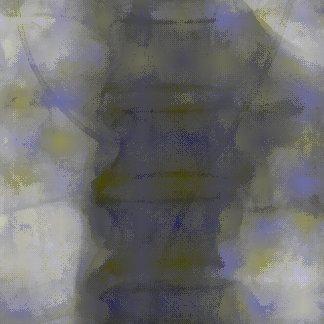 7.gif