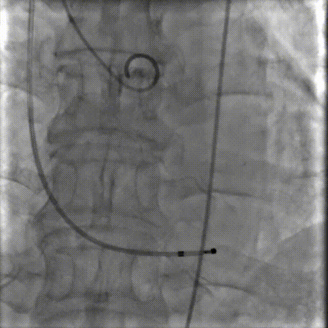 4.gif