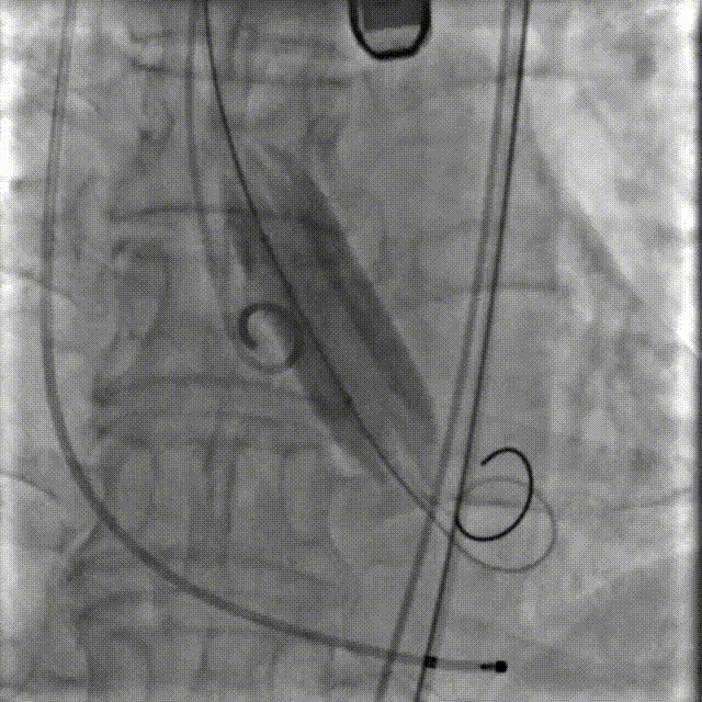 5.gif