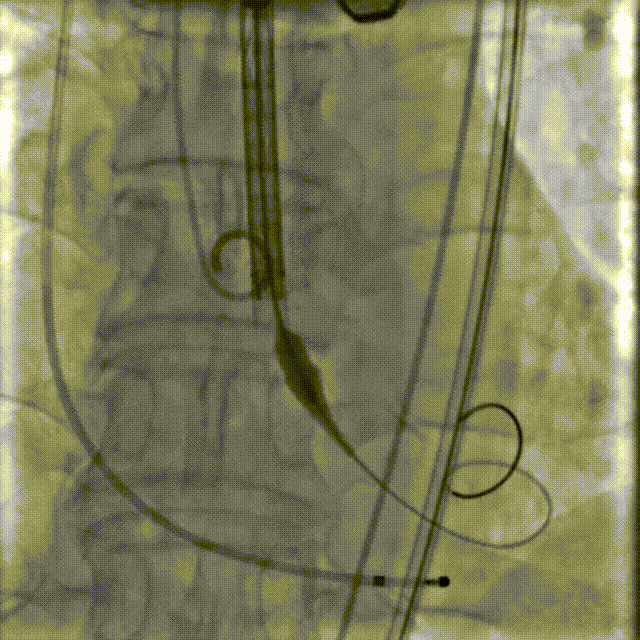 6.gif