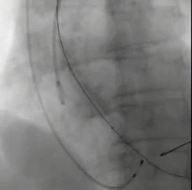 8.gif