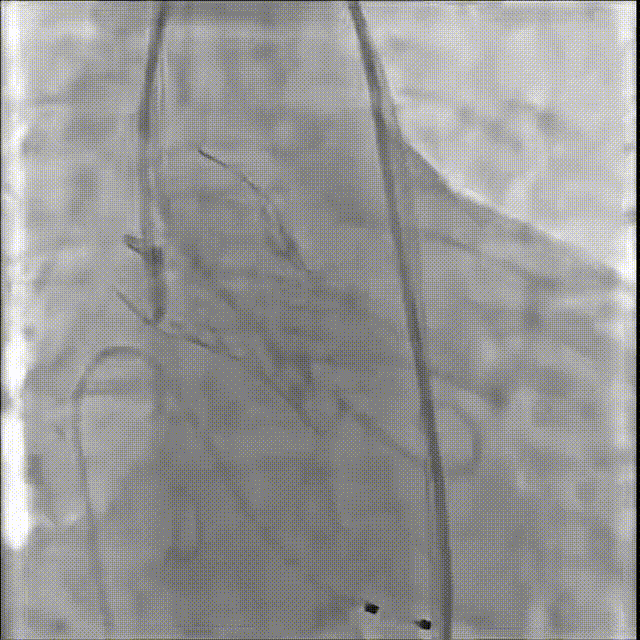 10.gif