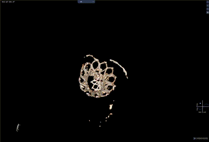 da0e15bd92ef69a100d398b25cb0bd3d_640_wx_fmt=gif&from=appmsg&tp=webp&wxfrom=10005&wx_lazy=1#imgIndex=15.gif